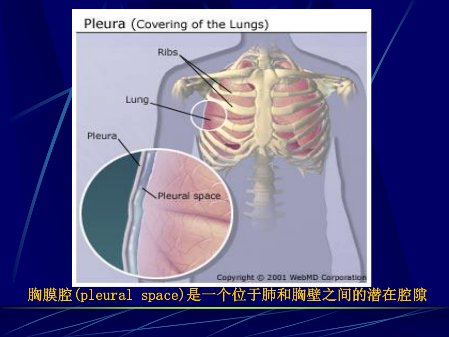 胸腔积液(修改).ppt_第3页