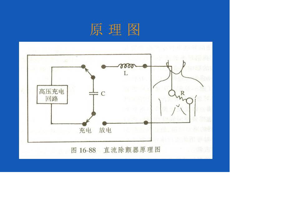 心脏电除颤术(Lee).ppt_第3页