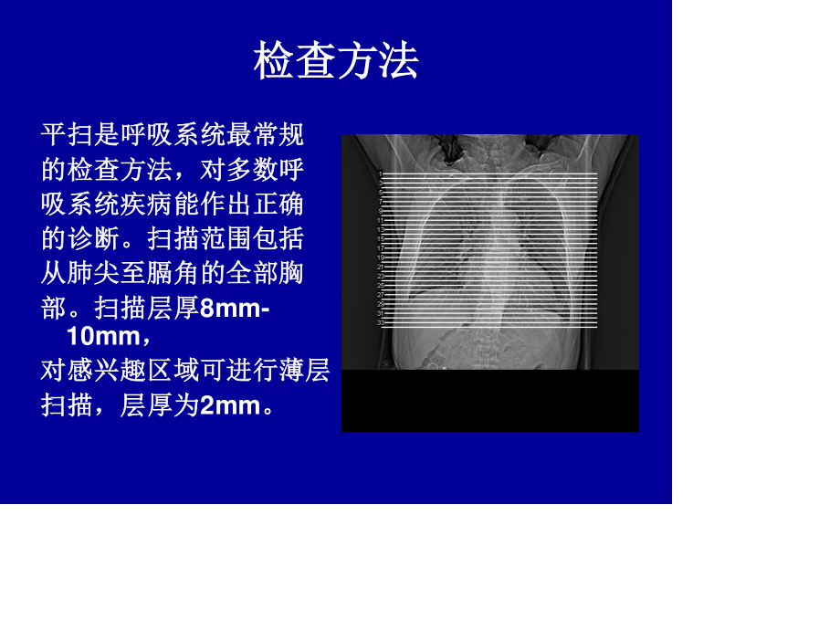 胸部CT基础知识.ppt_第3页