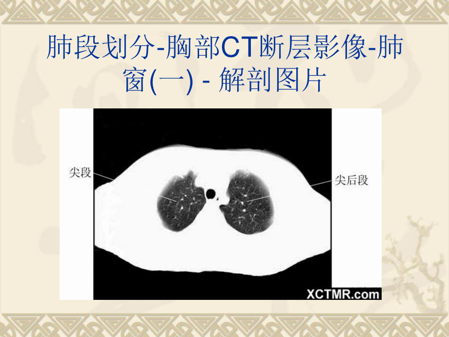 胸、上腹和盆腔CT详细实用图解.ppt_第3页