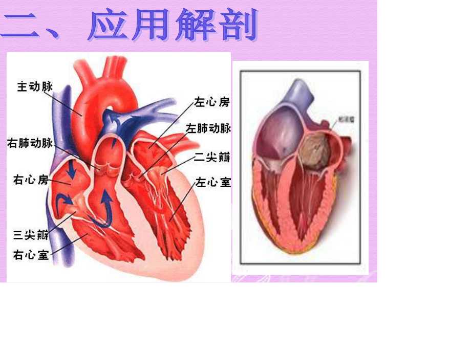 心脏粘液瘤手术配合.ppt_第3页