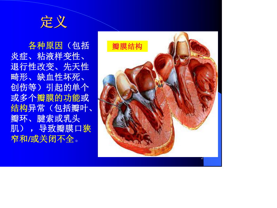 心瓣膜病.ppt_第2页