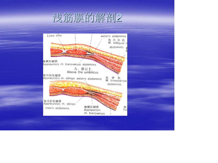 臀肌筋膜炎powerpoint.ppt_第3页