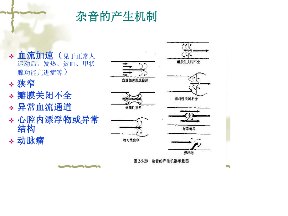 心脏听诊2五年制.ppt_第3页