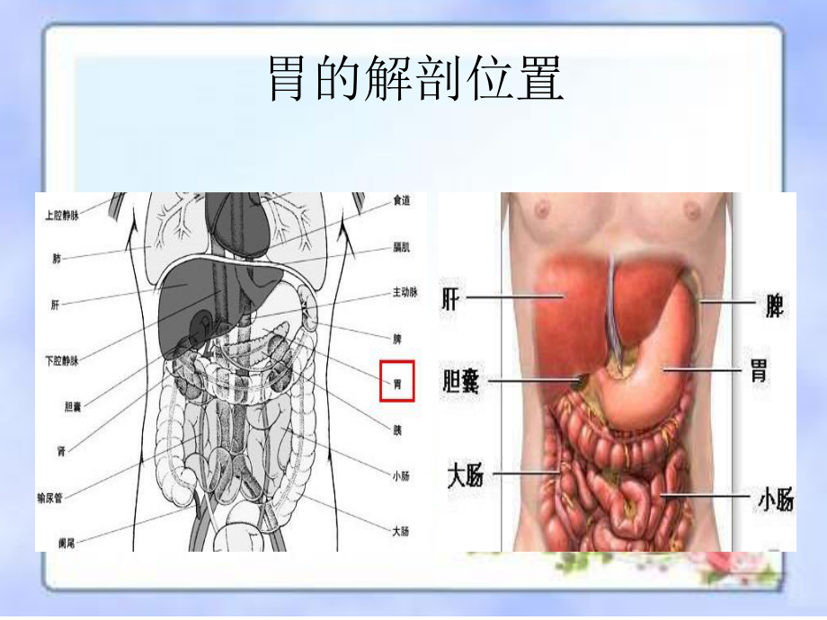 胃癌常见手术方式及术后并发症.ppt_第2页