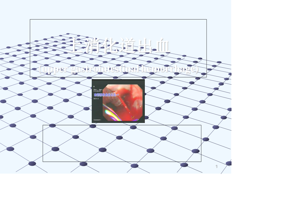 消化道出血(讲课用).ppt_第1页