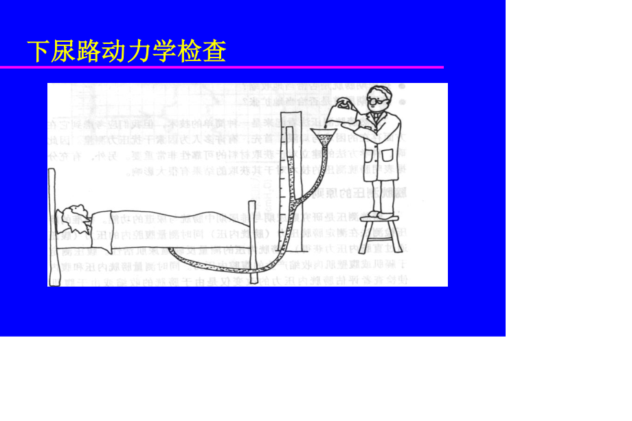 下尿路动力学检查.ppt_第1页