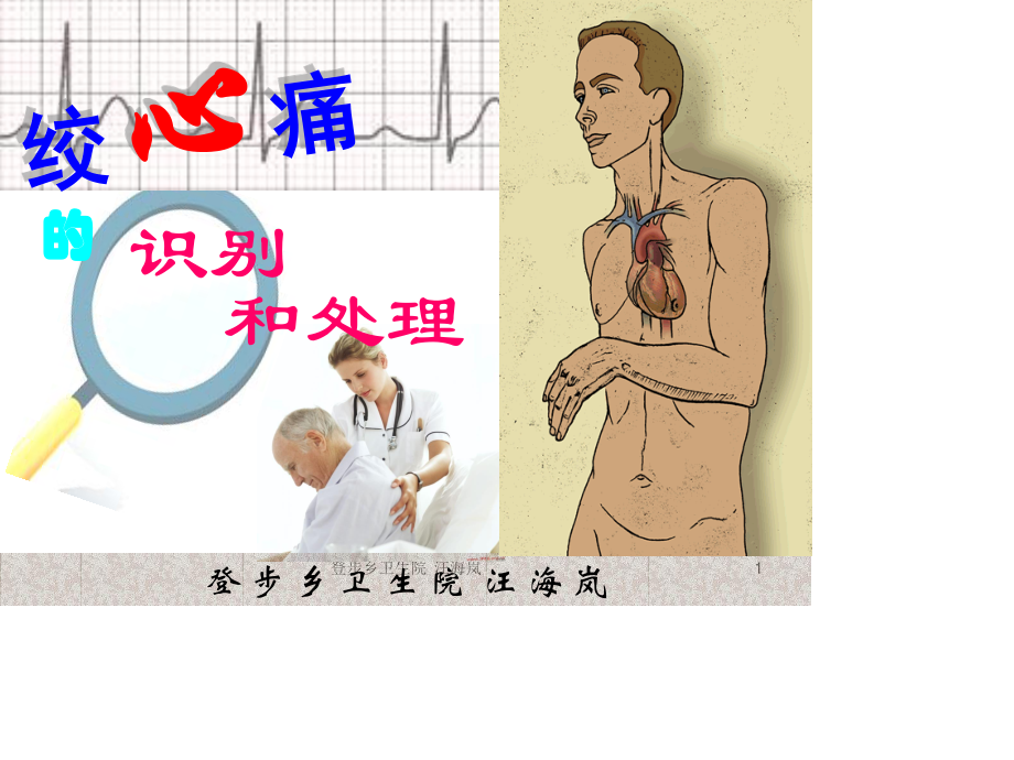 心绞痛识别和处置.ppt_第1页