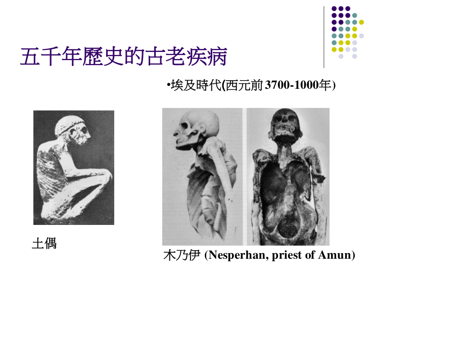 校园结核病防治.ppt_第3页