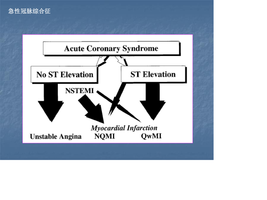 无ST段抬高的急性冠脉综合.ppt_第2页