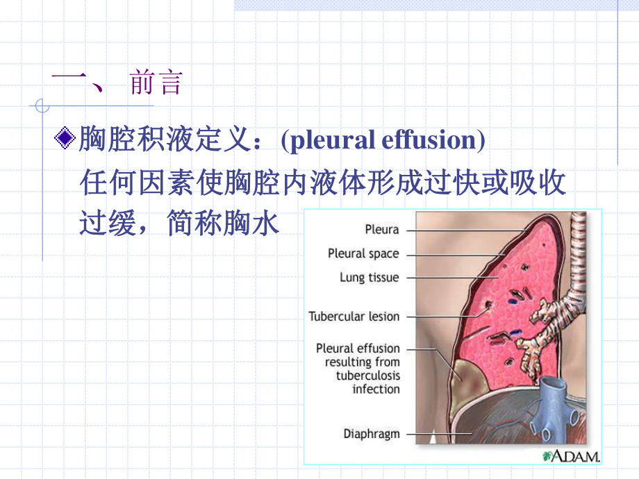 胸腔积液夏晓东-2010-2016.9.ppt_第3页