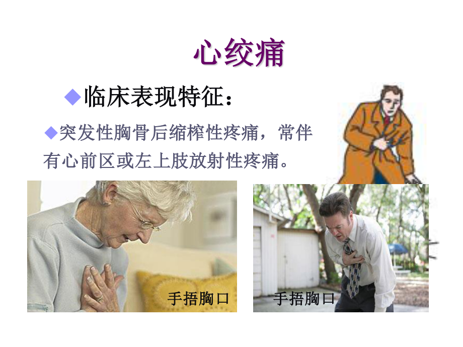 新抗心绞痛药春季.ppt_第3页