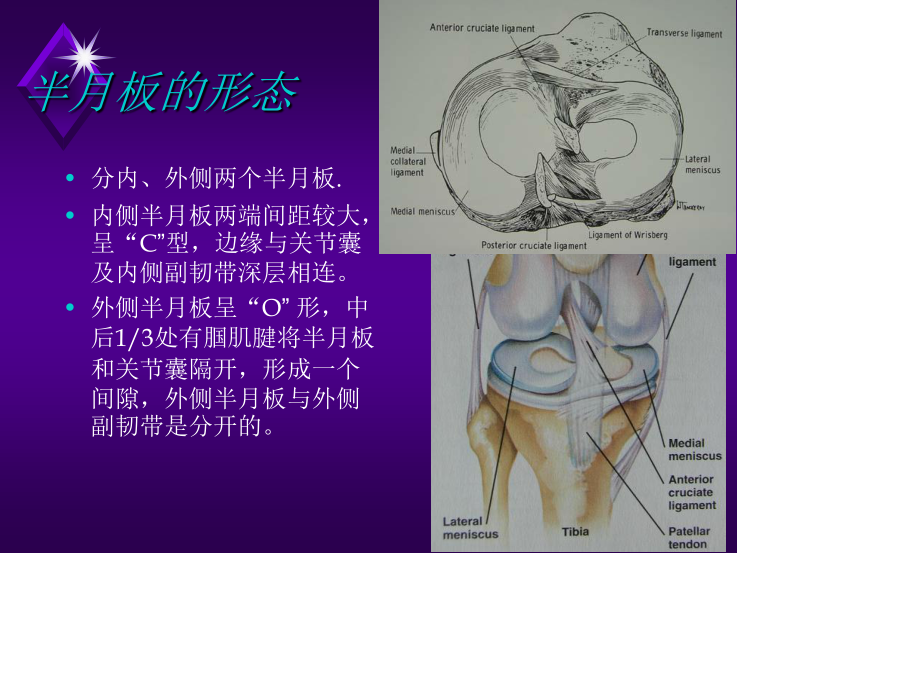 膝关节半月板损伤剖析.ppt_第3页