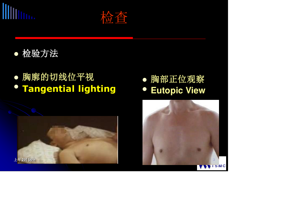 心脏查体幻灯.ppt_第3页