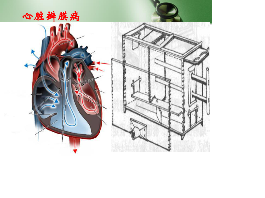 心脏瓣膜病郭武.ppt_第2页