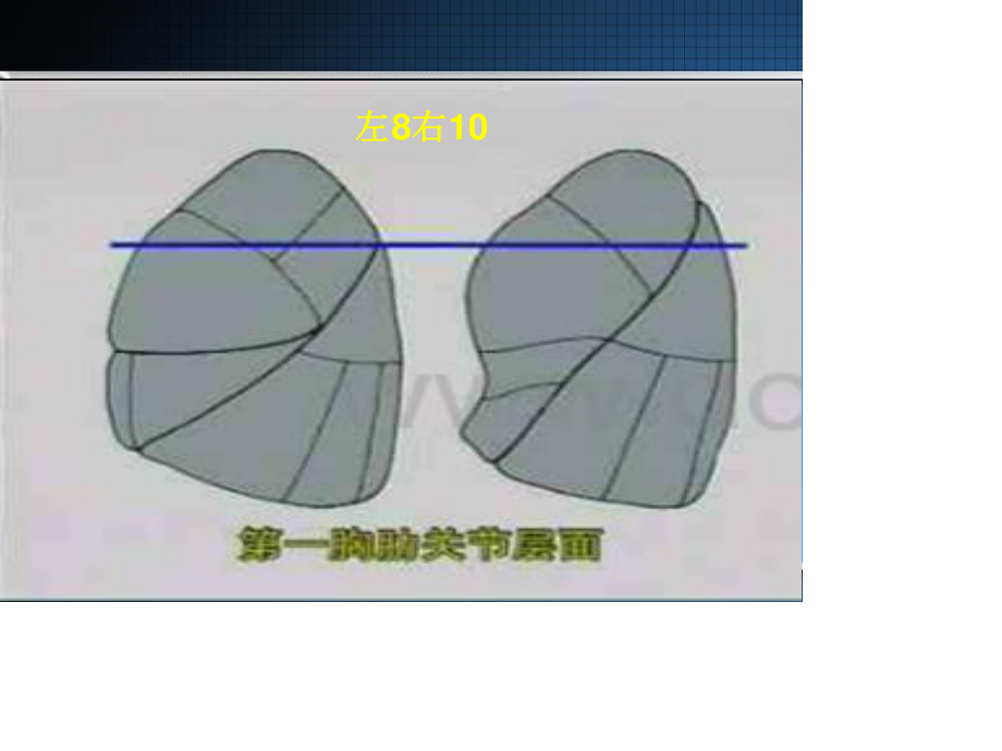 胸部CT读片指南.ppt_第2页