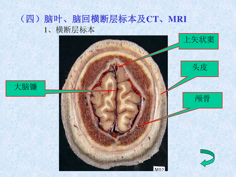 头颈部—fy.ppt_第1页