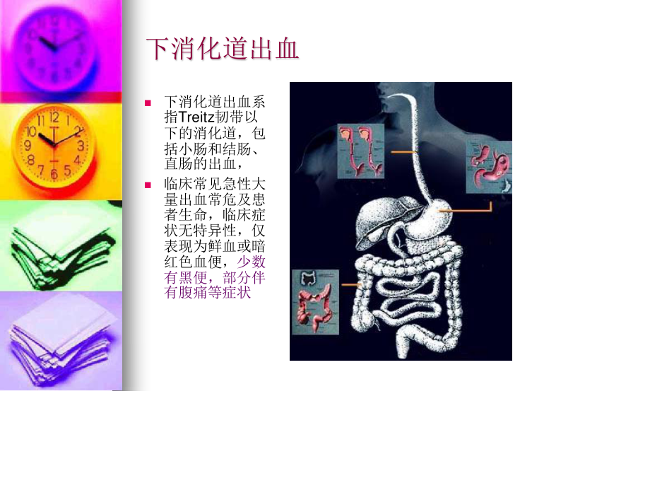 下消化道出血+腹痛.ppt_第2页