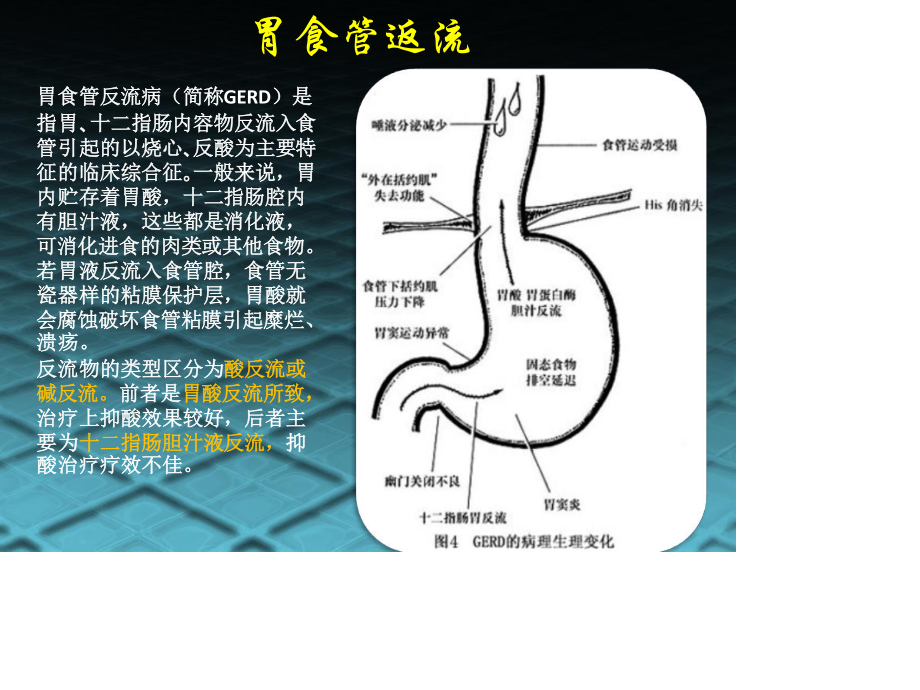 消化系统常见病及用药.pptx_第3页