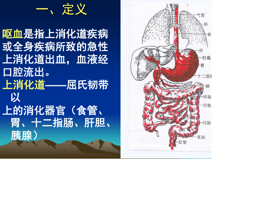 消化道出血诊疗.ppt_第2页