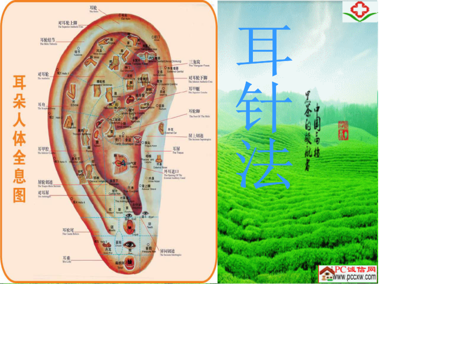 贴耳穴-操作方便非常实用性.ppt_第1页