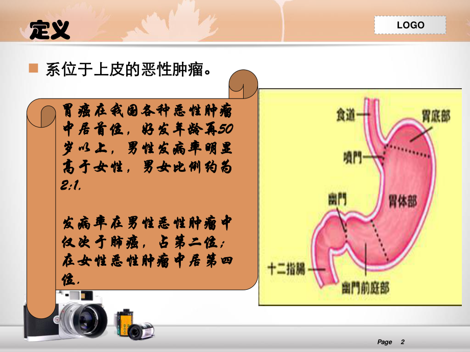 胃癌查房.ppt_第2页