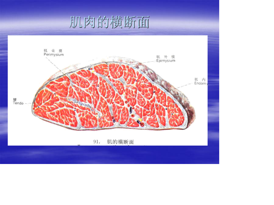 臀肌筋膜炎powerpoint资料.ppt_第1页