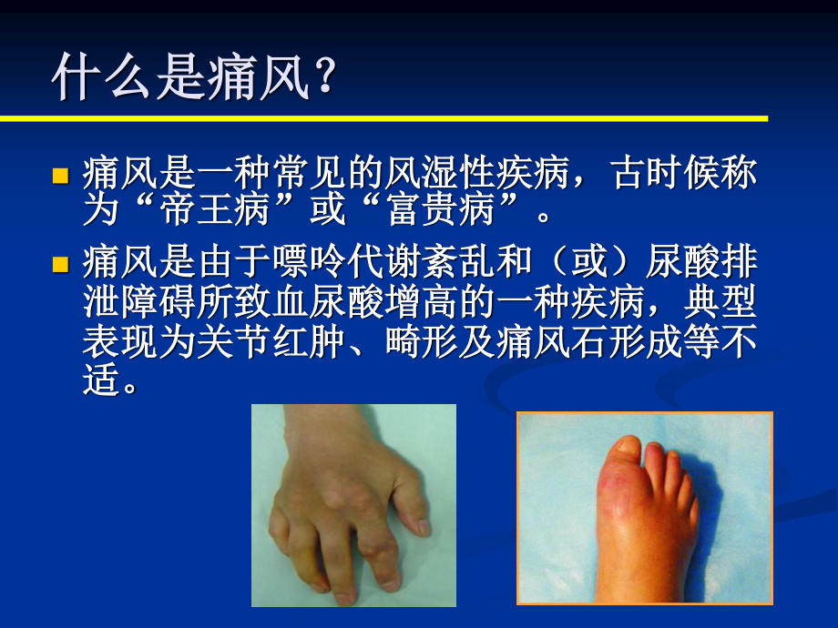 痛风健康科普讲座.ppt_第2页