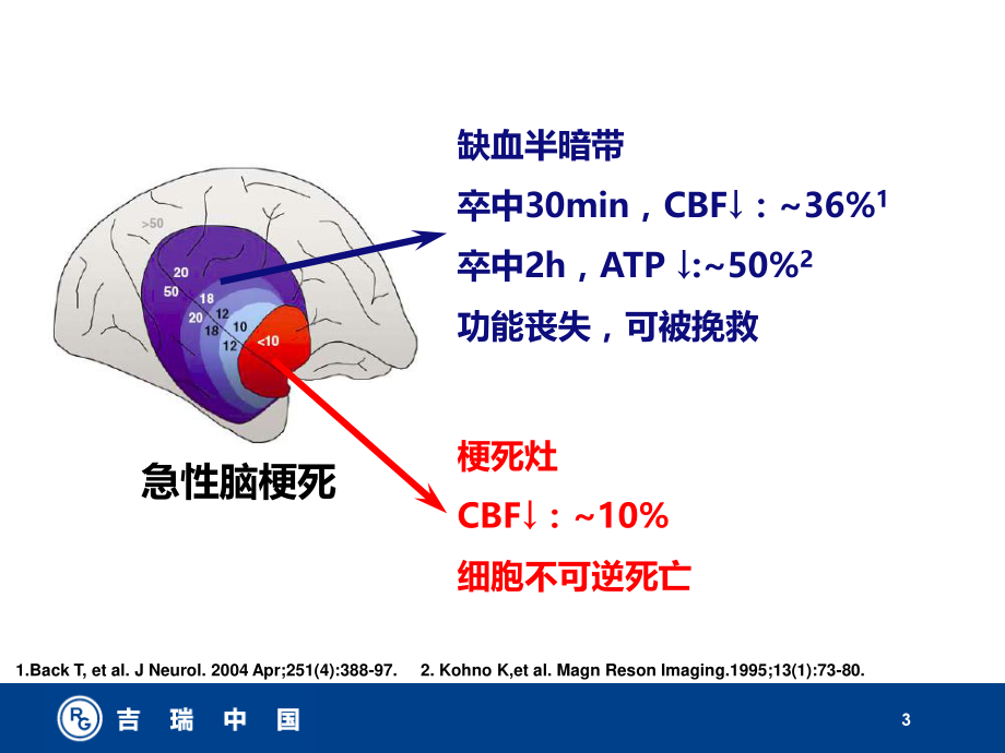 挽救缺血半暗带.ppt_第3页