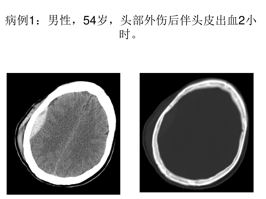 头颈部外伤病例常见病、多发病.ppt_第2页