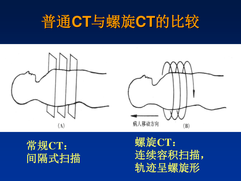 田氏西门子16排螺旋CT后处理技术的骨科应用.ppt_第3页