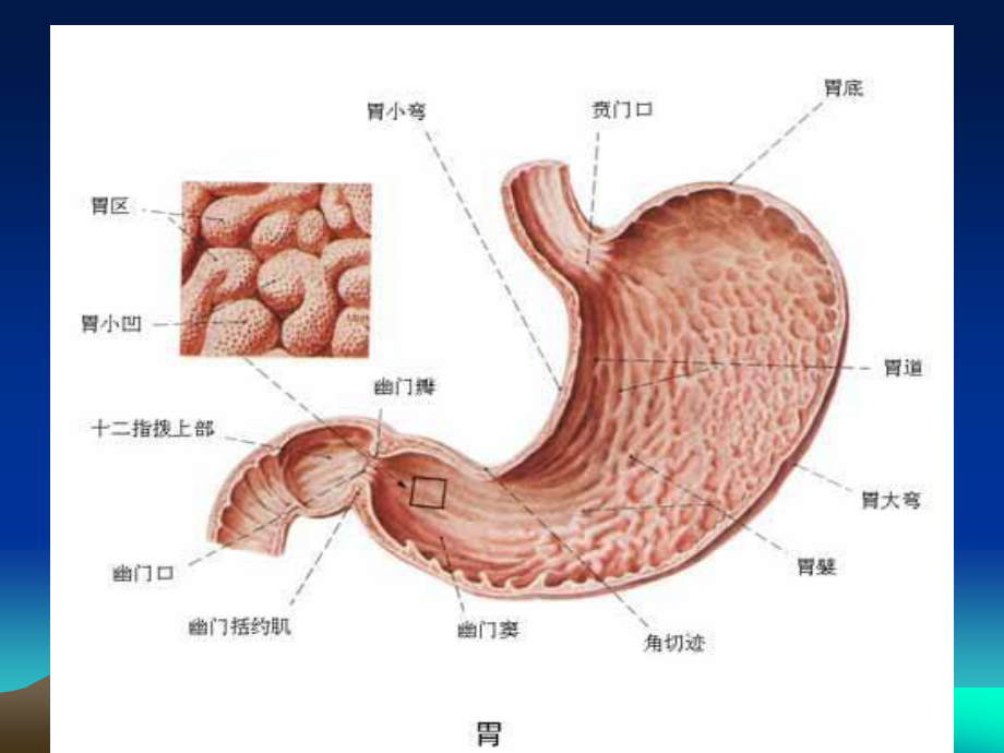 胃穿孔的诊治思路.ppt_第2页