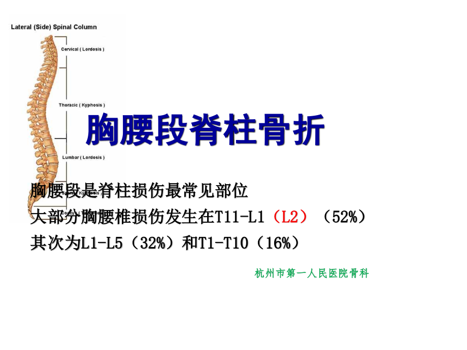 胸腰段脊柱骨折.ppt_第2页