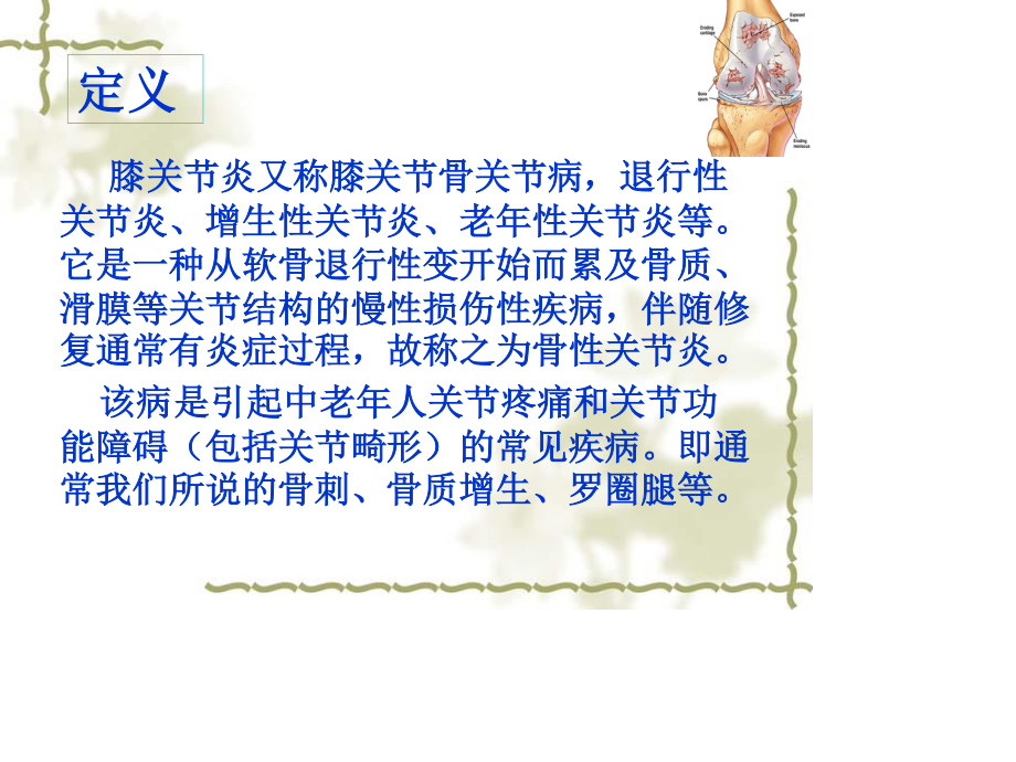 膝关节骨性关节炎.ppt_第2页