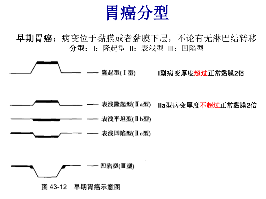 胃癌手术方式简介-淋巴结分区.pptx_第3页