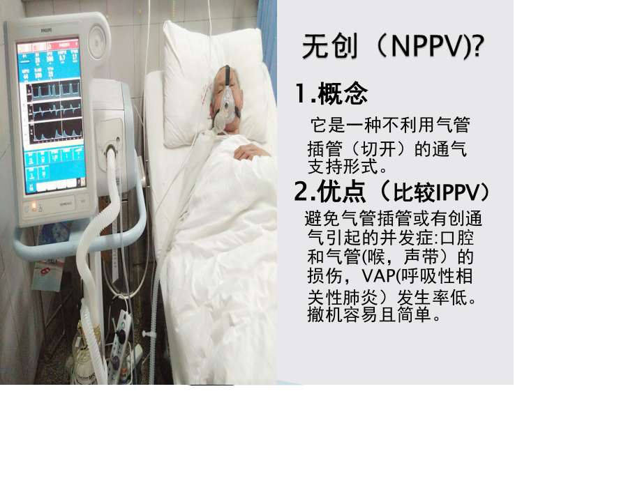 无创呼吸机的使用PPT.pptx_第2页