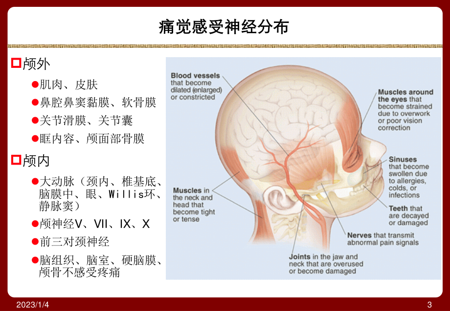 头痛与面部疼痛.ppt_第3页