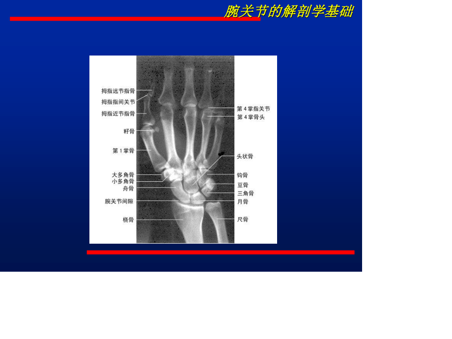 腕关节不稳的诊治.ppt_第3页