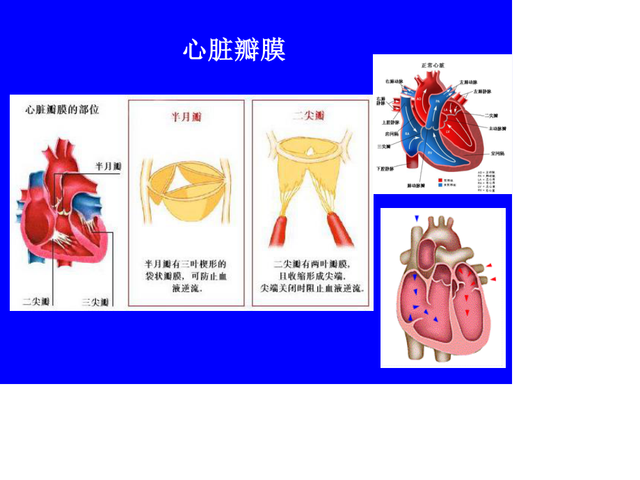 心脏瓣膜病(二尖瓣狭窄)2014.ppt_第2页