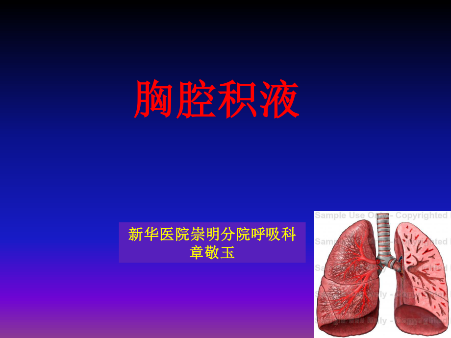 胸腔积液-zjy.ppt_第1页