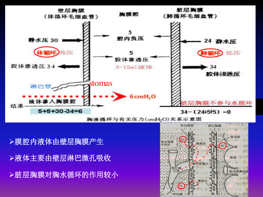 胸腔积液-zjy.ppt_第3页