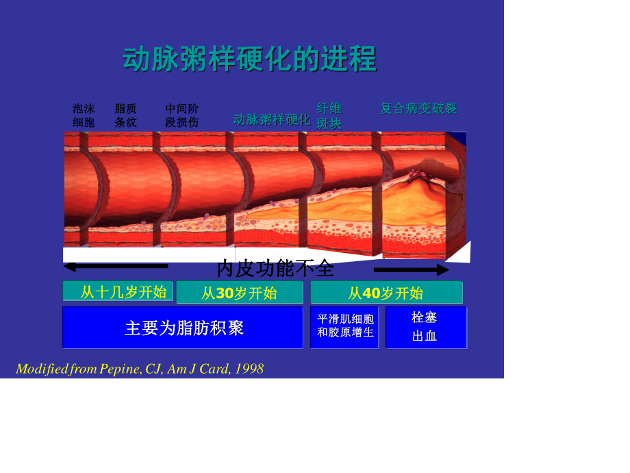 心绞痛和急性心梗.ppt_第3页