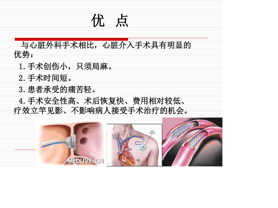 心脏介入.ppt_第3页