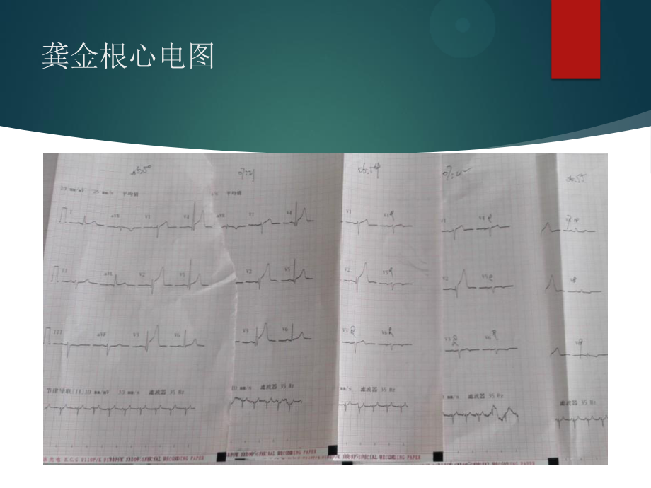 胸痛中心质量分析6.pptx_第3页