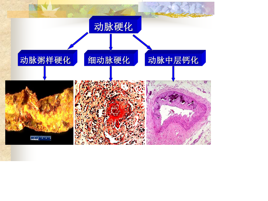 心血管研究生-jian.ppt_第3页