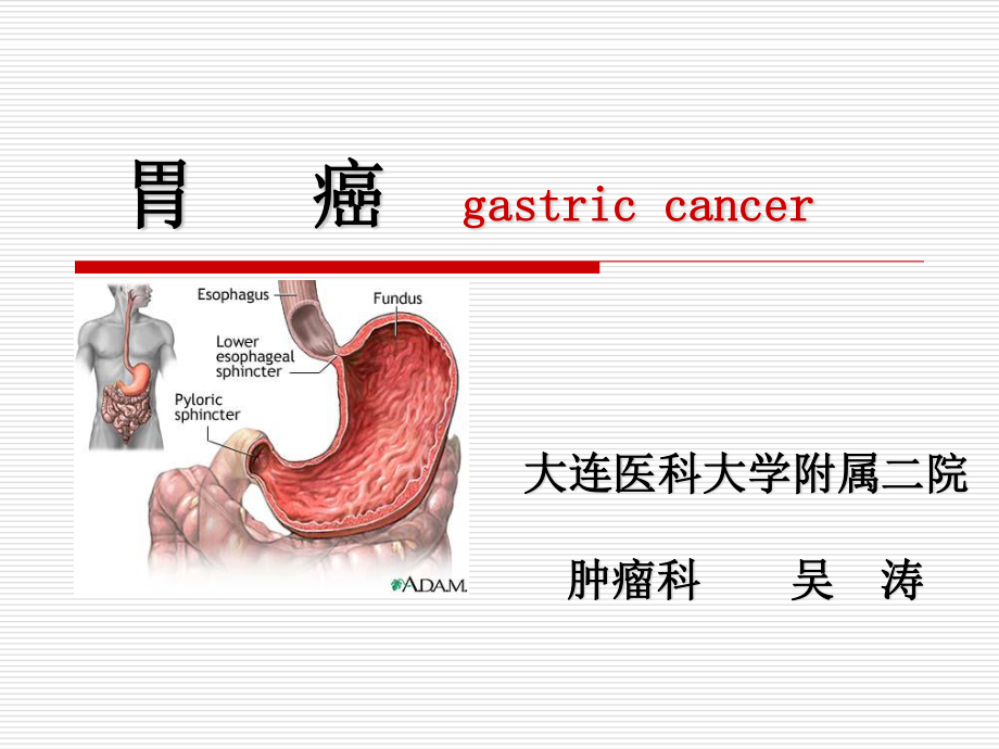 胃癌20091114.ppt_第1页