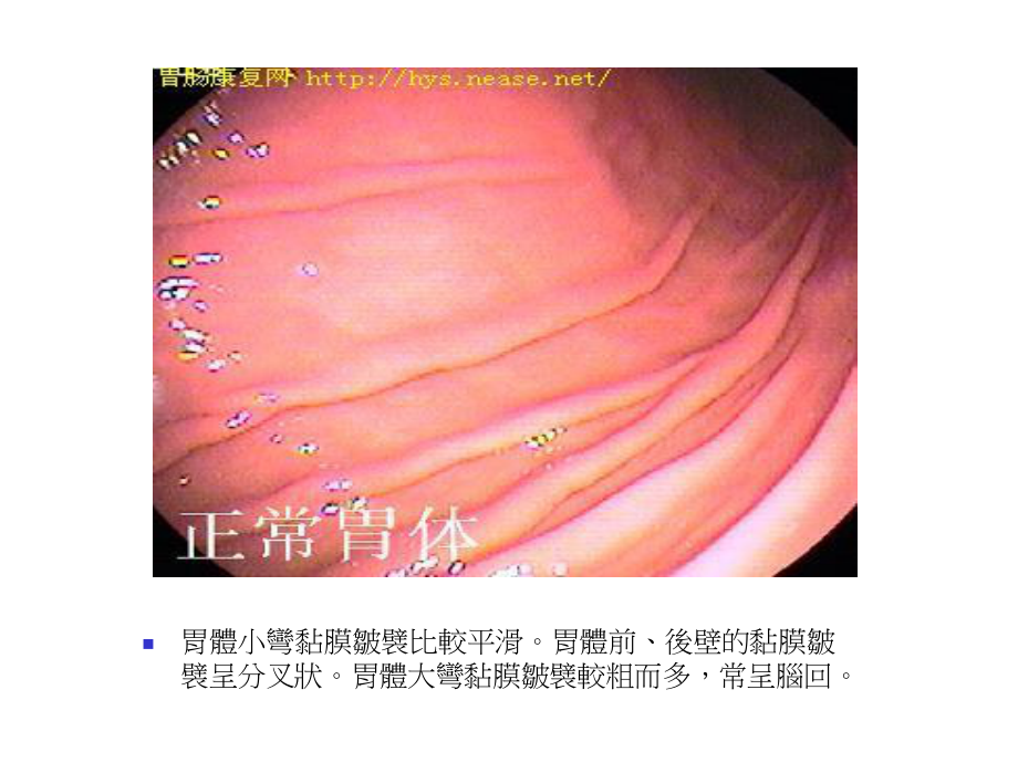 胃与十二指肠溃疡病的.ppt_第2页