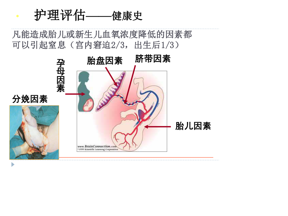 新生儿窒息-、颅脑损伤.ppt_第3页