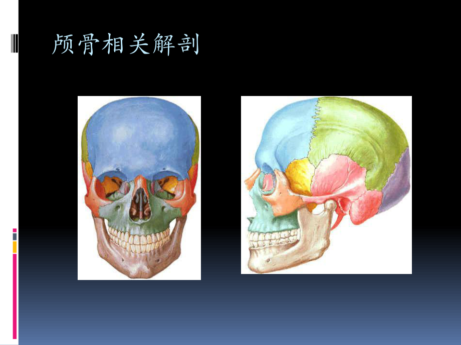 头部外伤CT检查规范.pptx_第2页