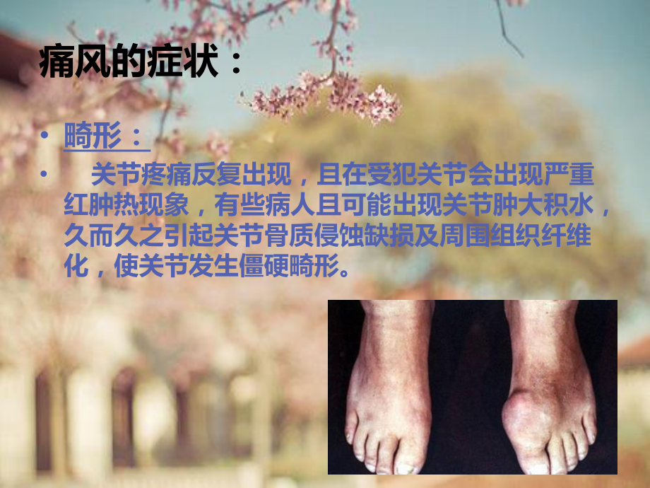 痛风的症状有哪些.ppt_第3页